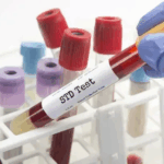 STD Test