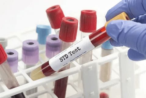 STD Test